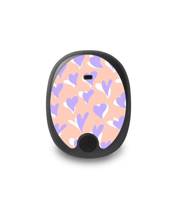 Lavender Love Eversense Smart Transmitter