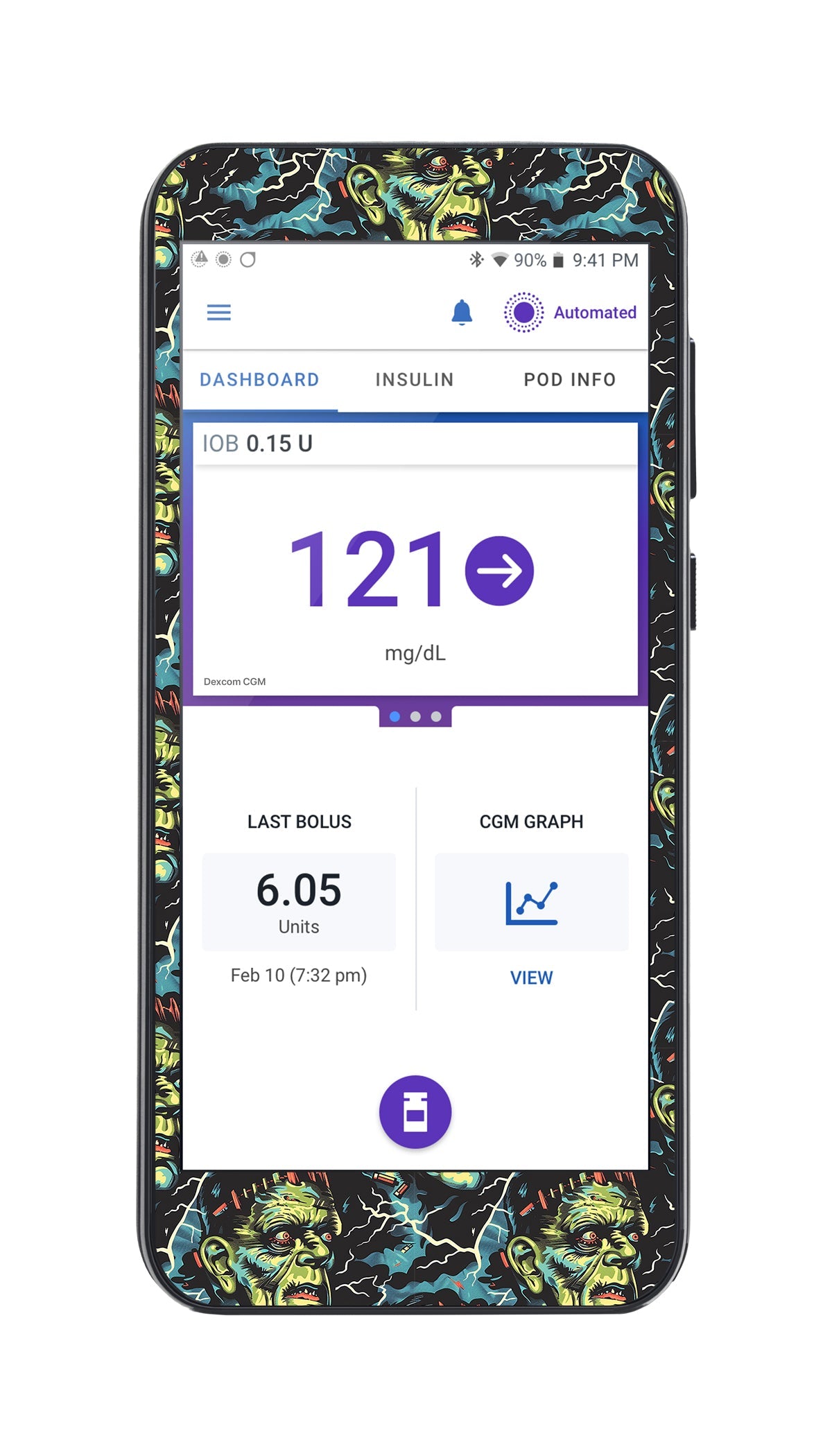 Frankie Omnipod 5™-Pump Peelz