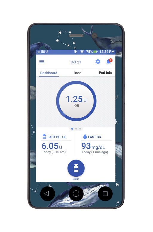 Midnight Whales For Omnipod Dash Peelz Pdm