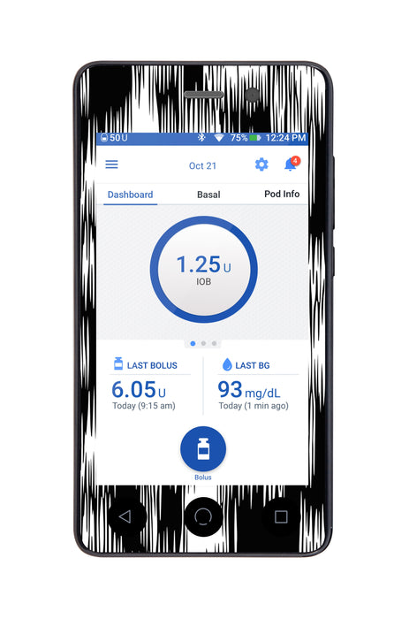 Static Interference Omnipod DASH™-Pump Peelz